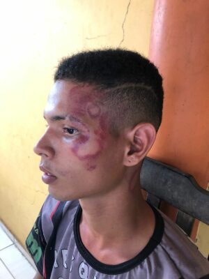 PM diz que vai apurar caso de agressão a jovem algemado e agredido com chineladas no rosto
